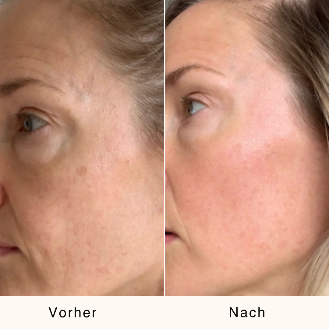 Bio-Kaktusfeigenkernöl – Straffend & Regenerierend | 30 ml