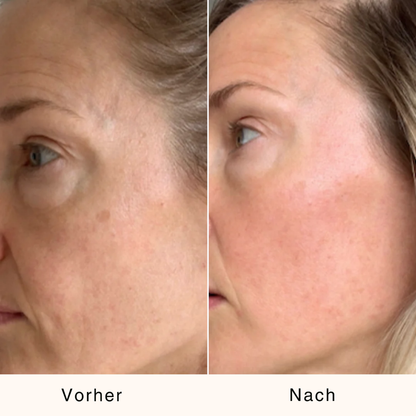 Bio-Kaktusfeigenkernöl – Straffend & Regenerierend | 30 ml